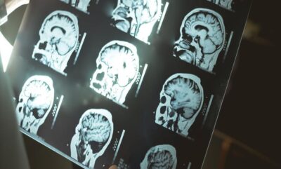 تحقیق جدید درباره رابطه چربی احشایی و شناخت در افراد سالمند