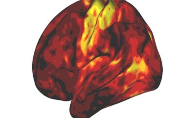 تحقیقات جدید درباره تأثیر واقعی داروهای بیش فعالی بر عملکرد مغز