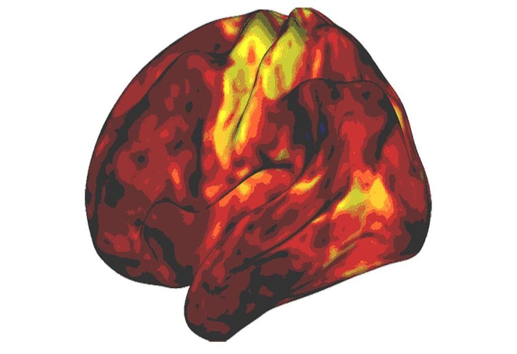 تحقیقات جدید درباره تأثیر واقعی داروهای بیش فعالی بر عملکرد مغز