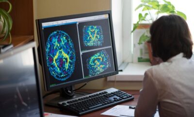 کشف مسیر عصبی جدید و بررسی نقش هیجان در حافظه