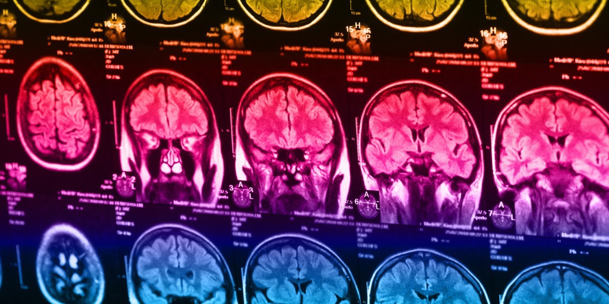 یافته های جدید علمی درباره رابطه اعتیاد به گوشی و حس طرد در مغز