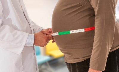 چاقی شکمی و میگرن؛ یافته های جدید علمی درباره ارتباط دور کمر با خطر ابتلا به سردرد