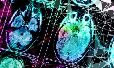 تفاوت جنسیتی در آلزایمر و نقش پروتئین ها در توقف رشد سلول ها؛ چرا زنان آلزایمر میگیرند ؟