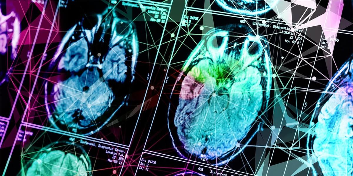 تفاوت جنسیتی در آلزایمر و نقش پروتئین ها در توقف رشد سلول ها؛ چرا زنان آلزایمر میگیرند ؟