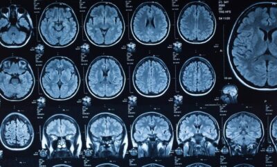 دانشمندان مراحل تحول مغز در طول عمر را در 5 فاز متمایز شناسایی کردند