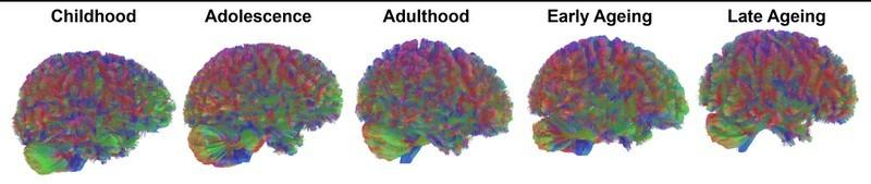 گرافیکی از مراحل تحول مغز در طول عمر و نقاط عطف آن