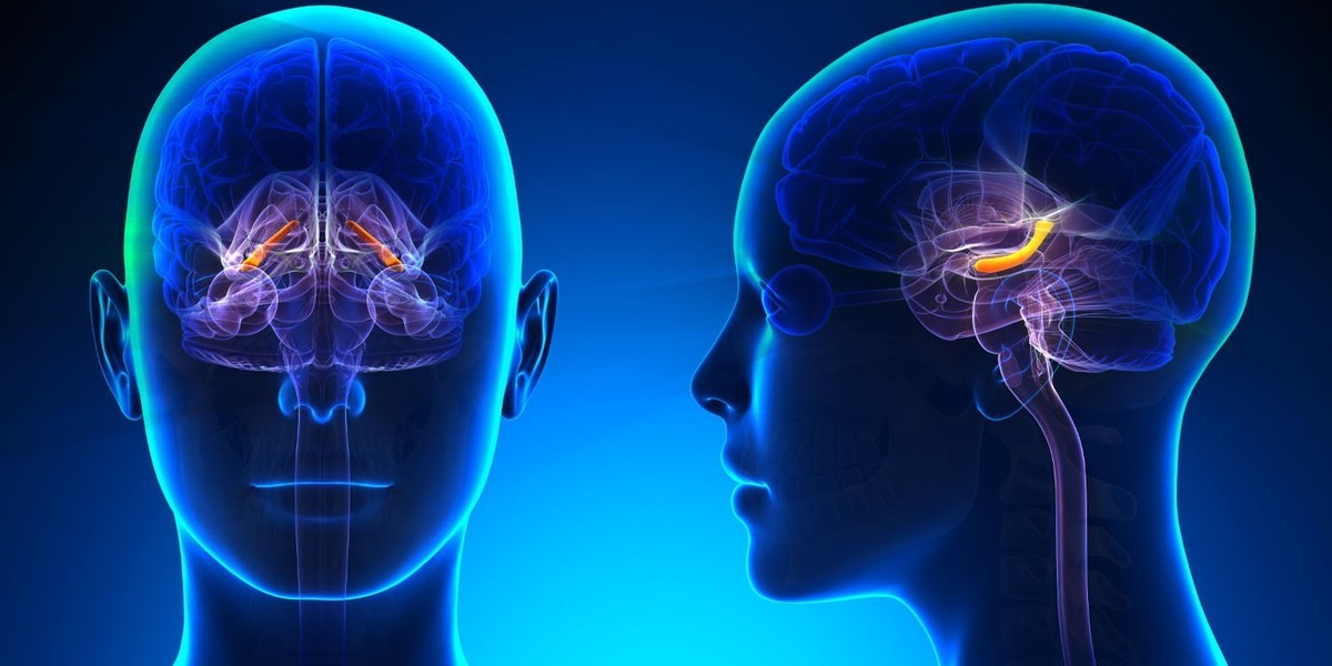 پیش بینی پاسخ اس سیتالوپرام با استفاده از ساختار هیپوکامپ مغز