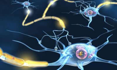 تحلیل واکنش متفاوت مغز به شیرین کننده مصنوعی و قند