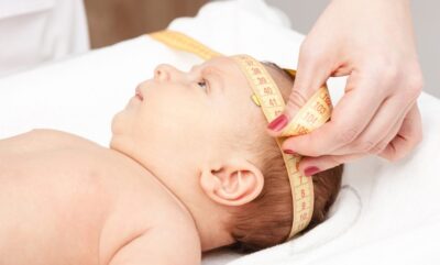 ارتباط میان خطر اوتیسم و رشد سر نوزاد در سال اول زندگی