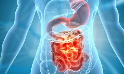 یافته های جدید دانشمندان درباره رابطه روده با ضعف حافظه در سالمندی