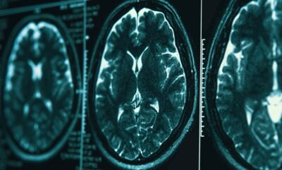 ارتباط آلودگی هوای کودکی و سلامت مغز با تضعیف حافظه در سالمندی