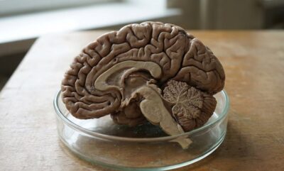 تفاوت جنسیتی اوتیسم و بررسی تئوری مغز مردانه افراطی در زنان