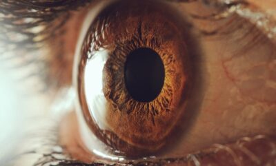 علت اصلی مشکلات نگاه در کودکان بیش فعال و نقص در پردازش چهره