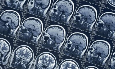 کشف علمی چگونگی تجربه حالت معنوی بدون دارو در مغز