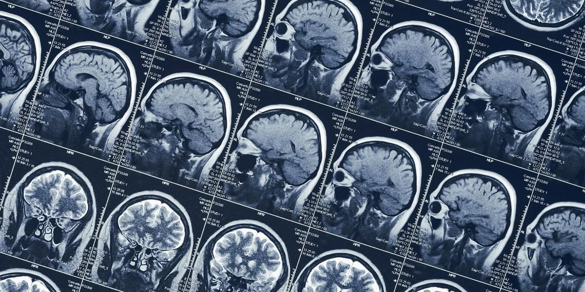 کشف علمی چگونگی تجربه حالت معنوی بدون دارو در مغز